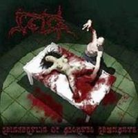 ++Retch+ - +Reinsertion+Of+Aborted+Remnants+ (2001)